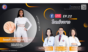 สมาคมแพทย์ผิวหนังฯ เชิญรับชมเพจเฟซบุ๊ก     “ครบเครื่องเรื่องผิวหนัง”EP.22 ตอน “โรคด่างขาว”